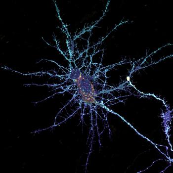 Airyscan Fast Zstack