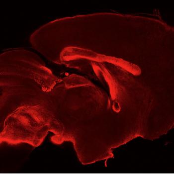 Sagittal Section PLP