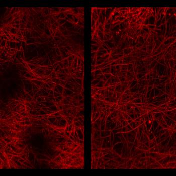 mouse medial prefontal cortex