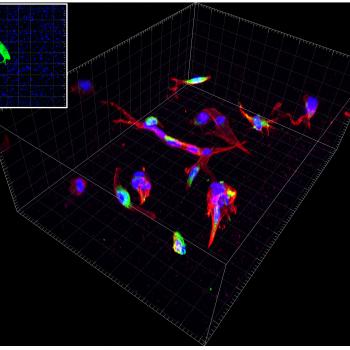 Primary Human hepatic stellate cells