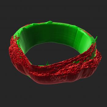 skeletal muscle ring-shaped tissues