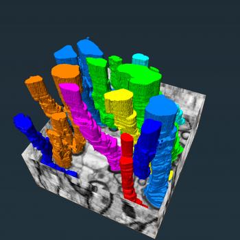 A section of piglet corpus callosum processed using serial block-face scanning electron microscopy. Myelinated axons are depicted by the dark circular rings.