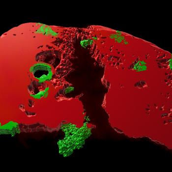 The image shows engineered antibodies (green) bound to host pathogens in mouse lung (red). 