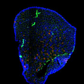 A plantaris muscle stained for individual fiber types.