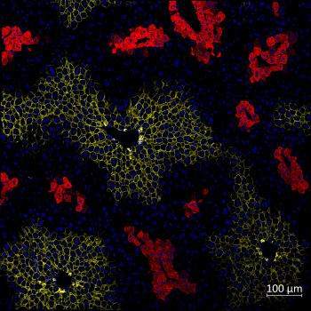 Immunofluorescence of mice liver sections with nuclei (blue) and zonal markers E-cadherin (periportal, yellow) and glutamine synthetase (pericentral, red).