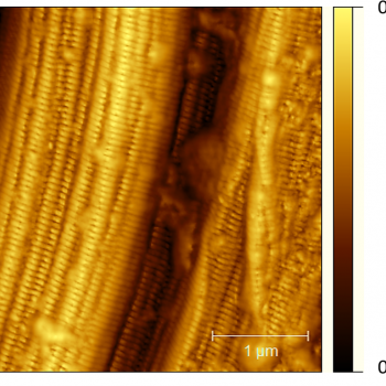Nnoscale collagen fibril arrangement in pig tendon.