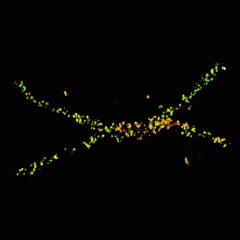 3D fused structure of two axial elements (AEs) during the diplotene stage of prophase I. The stained protein is SYCP3. 