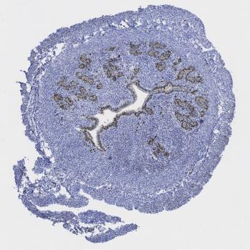 The tissue is from a mouse uterus that was stained with a Ki-67 antibody