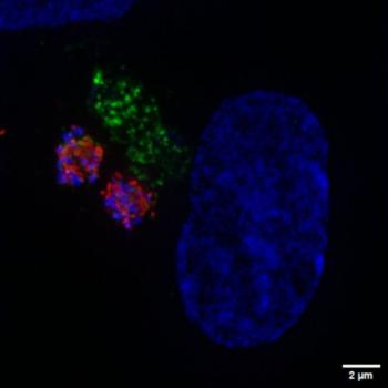  In the leftmost image there are two meronts (in green parasite protein, red parasite stain, blue nuclear stain), on top right corner the merozoites are escaping from the vacuole and on the bottom there is a mature meront. The center image shows two male gamonts (in red parasite protein, green parasite stain, blue nuclear stain) and two female gamonts (green parasite stain) next to each other. The rightmost image shows mature male gametes escaping from the gamont in an event refer to as “egress”. 