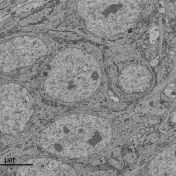 "This SBF-SEM image displays the cell body of a CA1 pyramidal neuron in the hippocampus. Our study aims to investigate mitochondrial morphology and complexity in the mouse hippocampal neurons."