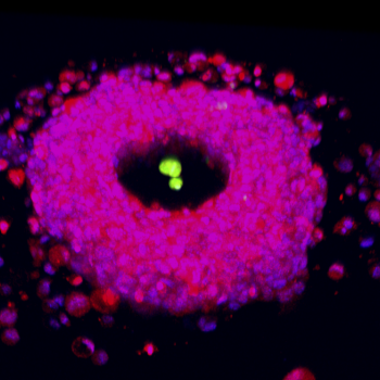 Liver progenitor cells (red) form a toroid shaped organoid around a PEG acrylate pillar. 