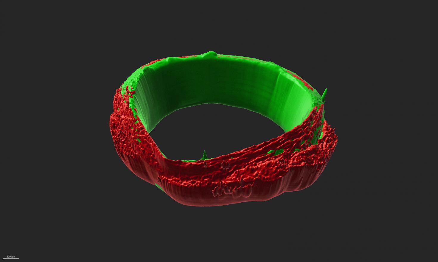 skeletal muscle ring-shaped tissues