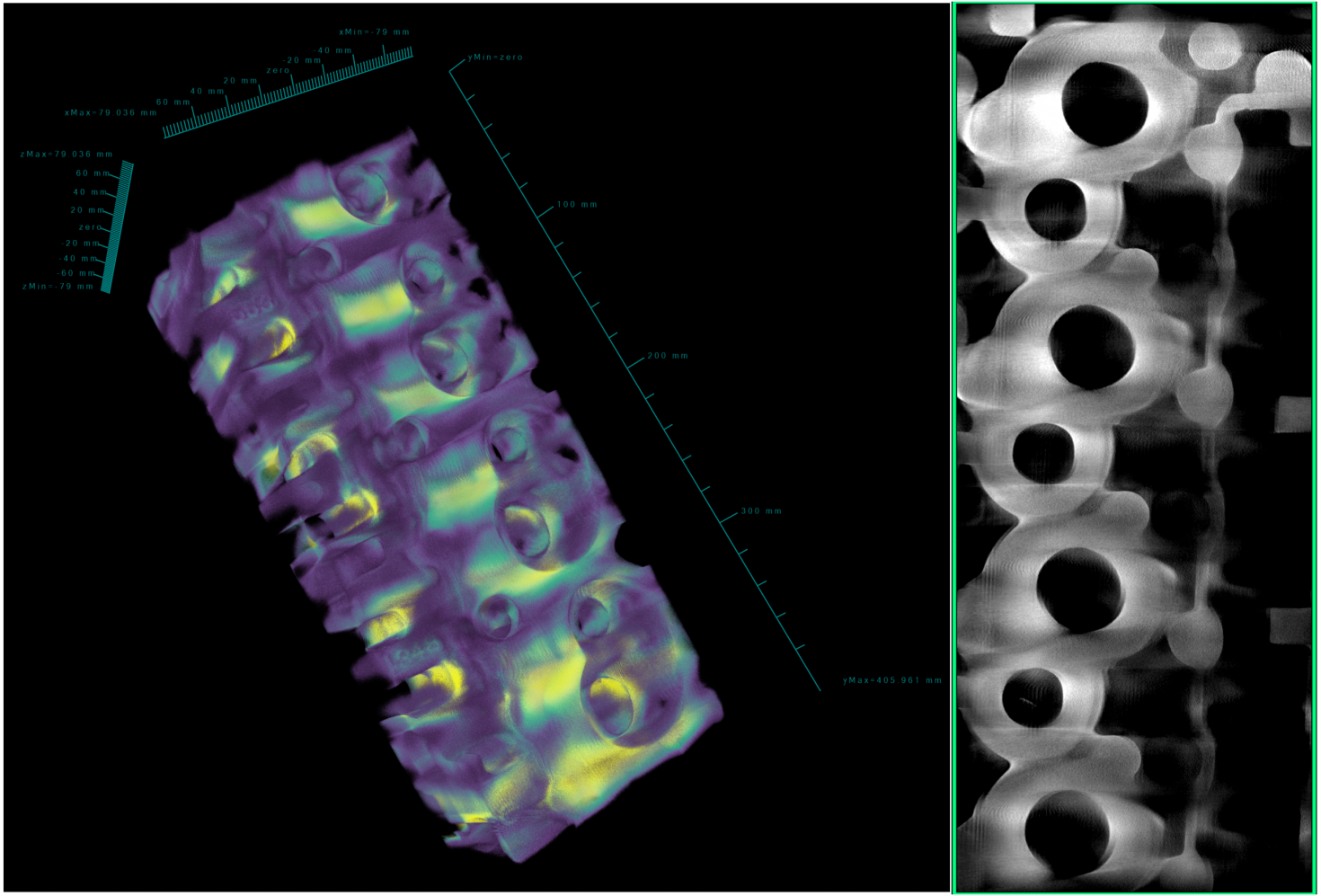 3D CT reconstruction of a high performance cylinder head cast from scrap aerospace aluminum alloy AA7075