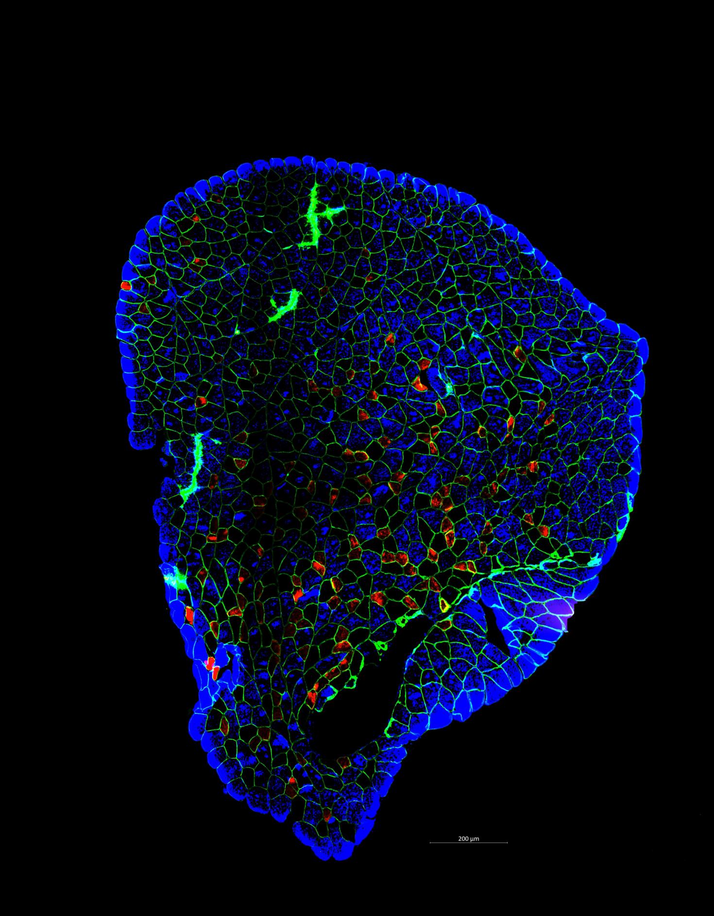 A plantaris muscle stained for individual fiber types.