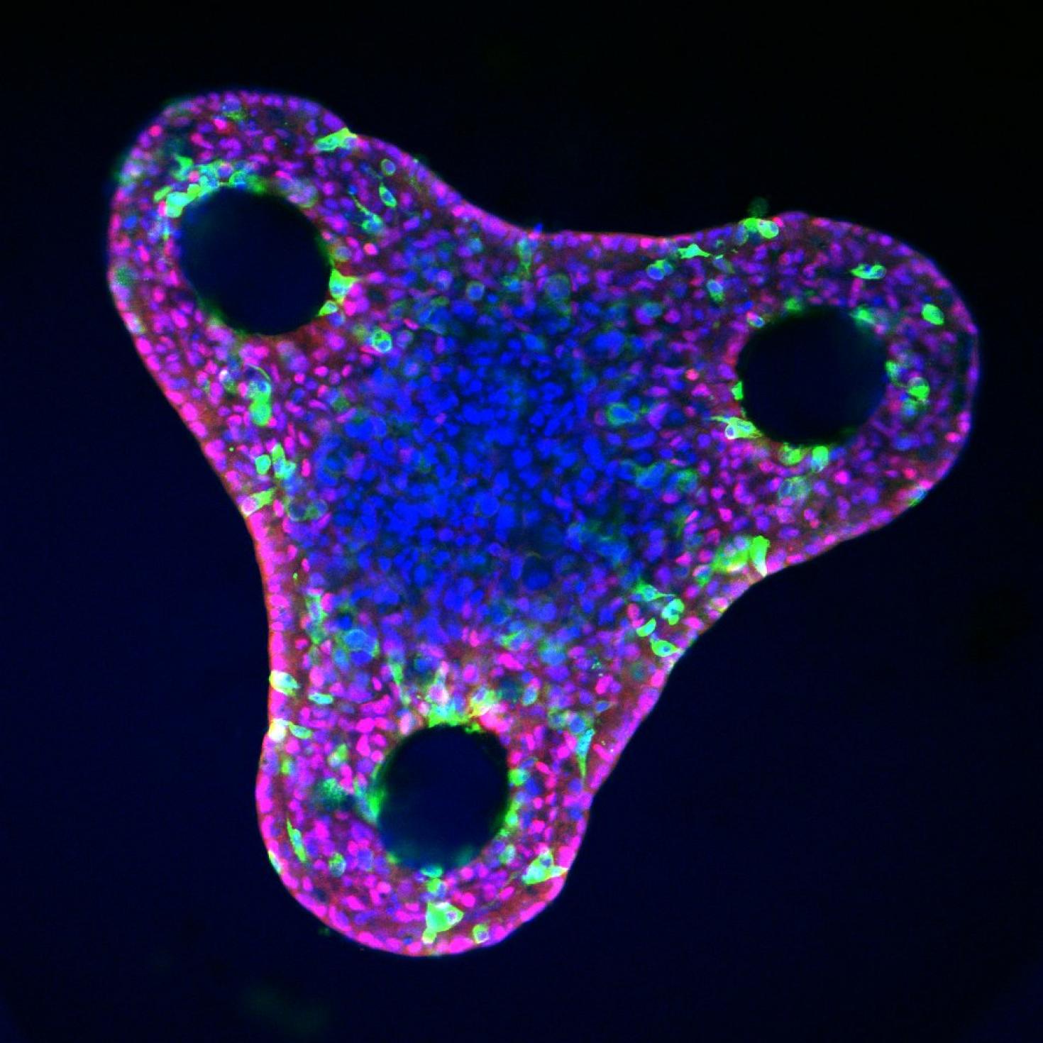 Liver organoid after differentiation in a triangular microwell.