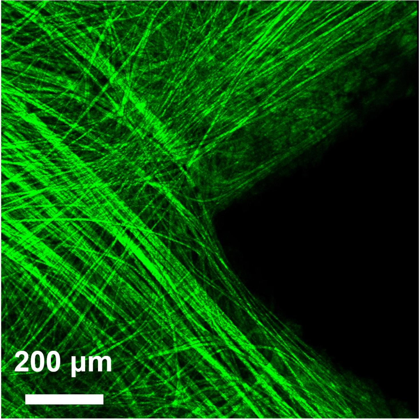 This second-harmonic generation (SHG) image shows collagen fibers in bovine Glisson’s capsule as the tissue is being cut by a razor blade.