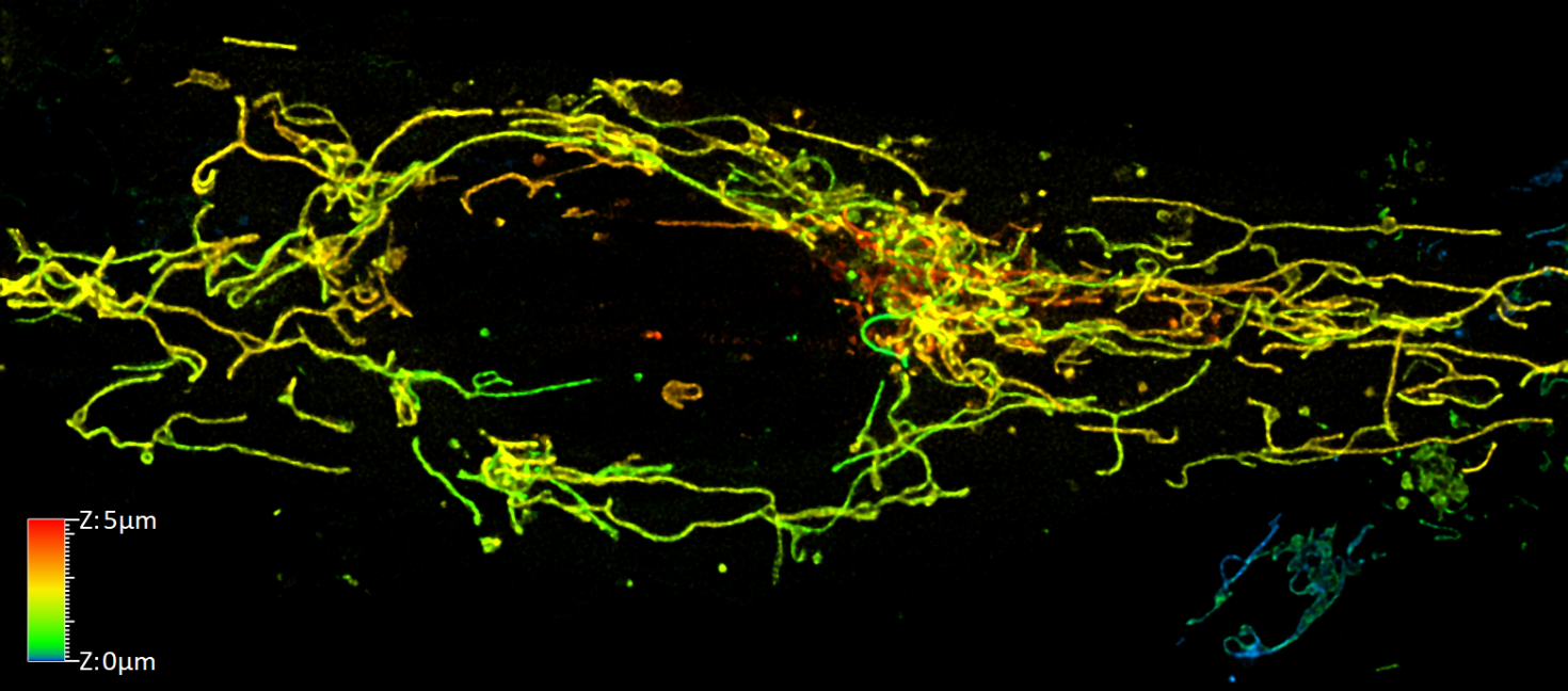 Confocal images of hiPSC derived pericytes after being treated with a low dosage (1ng/mL) of IL-1beta to induce inflammation and stained with MitoTracker Green.