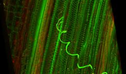 Eastern Filbert Blight