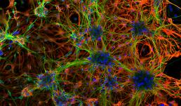 Hippocampal neurons