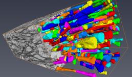 Section of piglet corpus callosum