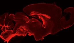 Sagittal Section PLP