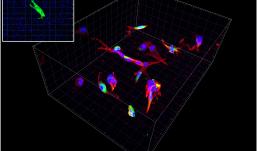 Primary Human hepatic stellate cells