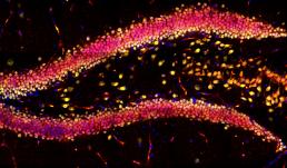 This image showcases the hippocampal region in a mouse brain slice, highlighting DAPI in blue, NeuN in green, and YAP in red using immunofluorescence.