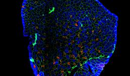 A plantaris muscle stained for individual fiber types.