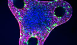 Liver organoid after differentiation in a triangular microwell.