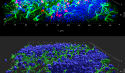 A study of exercise dependent yes-associated protein 1 (YAP) translocation from cytoplasm to the nucleus in astrocytes in the hilus of the hippocampus. The red is YAP, green is GFAP, and blue is DAPI. 
