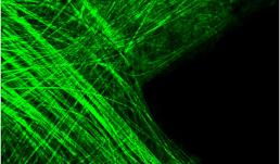 This second-harmonic generation (SHG) image shows collagen fibers in bovine Glisson’s capsule as the tissue is being cut by a razor blade.
