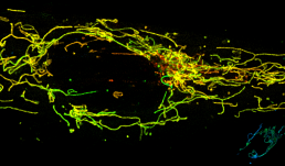 Confocal images of hiPSC derived pericytes after being treated with a low dosage (1ng/mL) of IL-1beta to induce inflammation and stained with MitoTracker Green.