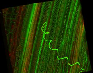 Eastern Filbert Blight