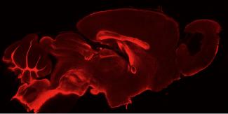 Sagittal Section PLP
