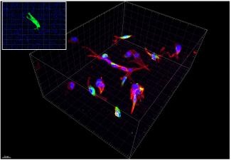 Primary Human hepatic stellate cells
