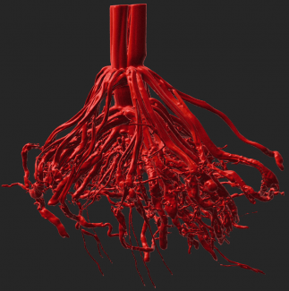This crown root from biomass sorghum grown in the field under restricted water supply using our rain-out facility as part of the CABBI project. 