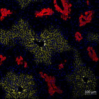 Immunofluorescence of mice liver sections with nuclei (blue) and zonal markers E-cadherin (periportal, yellow) and glutamine synthetase (pericentral, red).