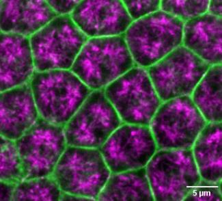 This image demonstrates a surface view of Drosophila embryo undergoing cellularization, depicting microtubule in magenta and Actin in green.