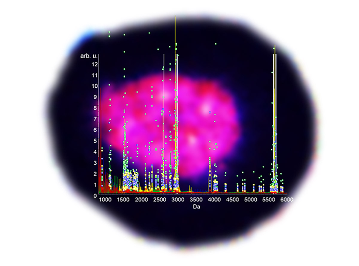 Mass spectroscopic data acquired from multiple samples of the islets of Langerhans have been overlaid on isolated individual human islet of Langerhans that have been stained with dithizone. 