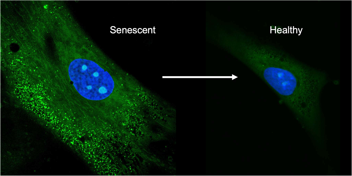Confocal images of mesenchymal stem cells. The left shows the senescent cells producing unwanted biomolecules, the right shows the cells after treatment with the antioxidant crystals