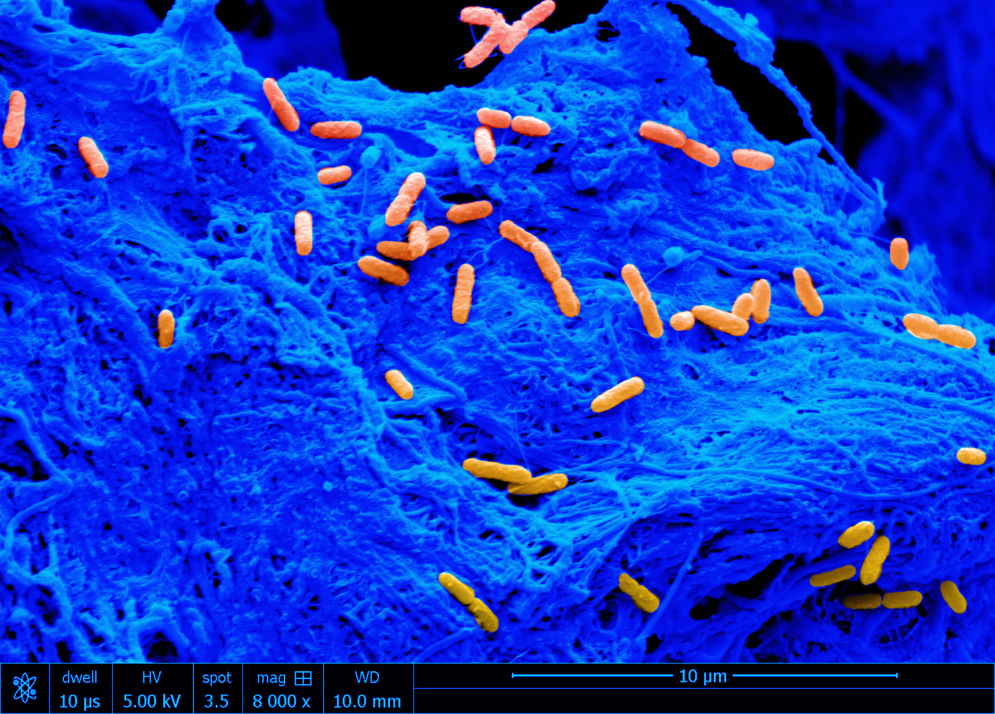 Individual Pseudomonas aeruginosa cells (orange) on the surface of the collagen scaffold (blue).