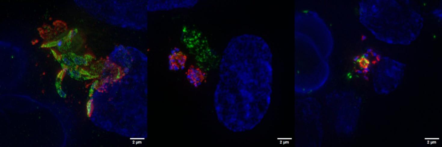  In the leftmost image there are two meronts (in green parasite protein, red parasite stain, blue nuclear stain), on top right corner the merozoites are escaping from the vacuole and on the bottom there is a mature meront. The center image shows two male gamonts (in red parasite protein, green parasite stain, blue nuclear stain) and two female gamonts (green parasite stain) next to each other. The rightmost image shows mature male gametes escaping from the gamont in an event refer to as “egress”. 