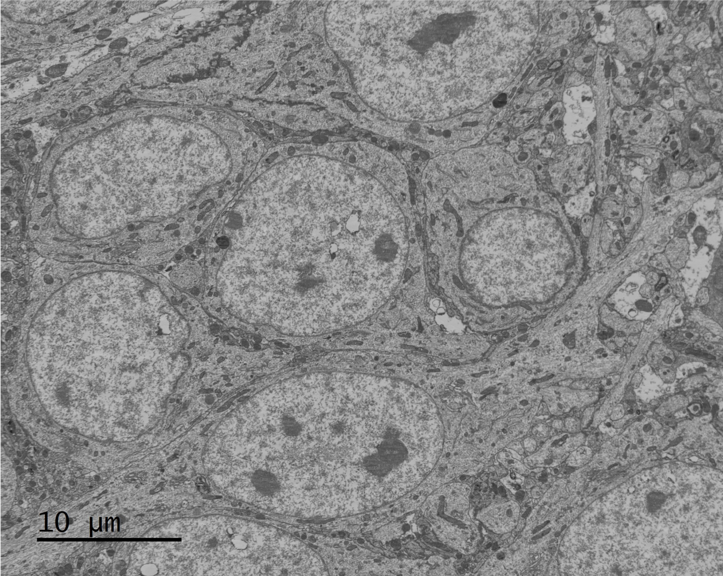 "This SBF-SEM image displays the cell body of a CA1 pyramidal neuron in the hippocampus. Our study aims to investigate mitochondrial morphology and complexity in the mouse hippocampal neurons."