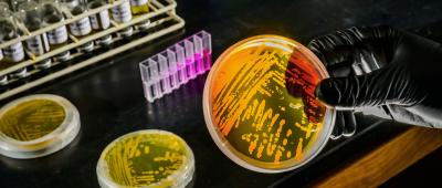 A research group co-led by the University of Illinois Urbana-Champaign predicts that a surprisingly adaptable species of marine archaea will play an important role in reshaping biodiversity in the planet’s oceans as the climate changes. Photo by Fred Zwicky