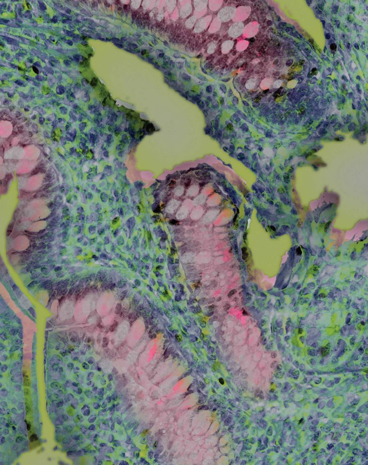 Growing appetite<br />
NanoZoomer Slide Scanner 