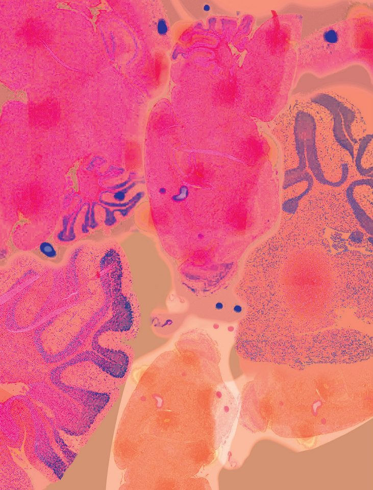 Defense Mechanisms<br />
NanoZoomer Slider Scanner
