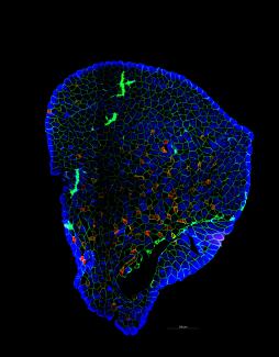 A plantaris muscle stained for individual fiber types.