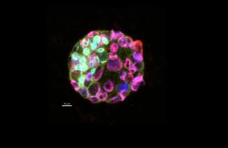 This embryo is part of a study to identify the effects of DEHP, which is a plasticizer whose chemical structure closely  resembles hormones and is believed to be an endocrine disruptor. 