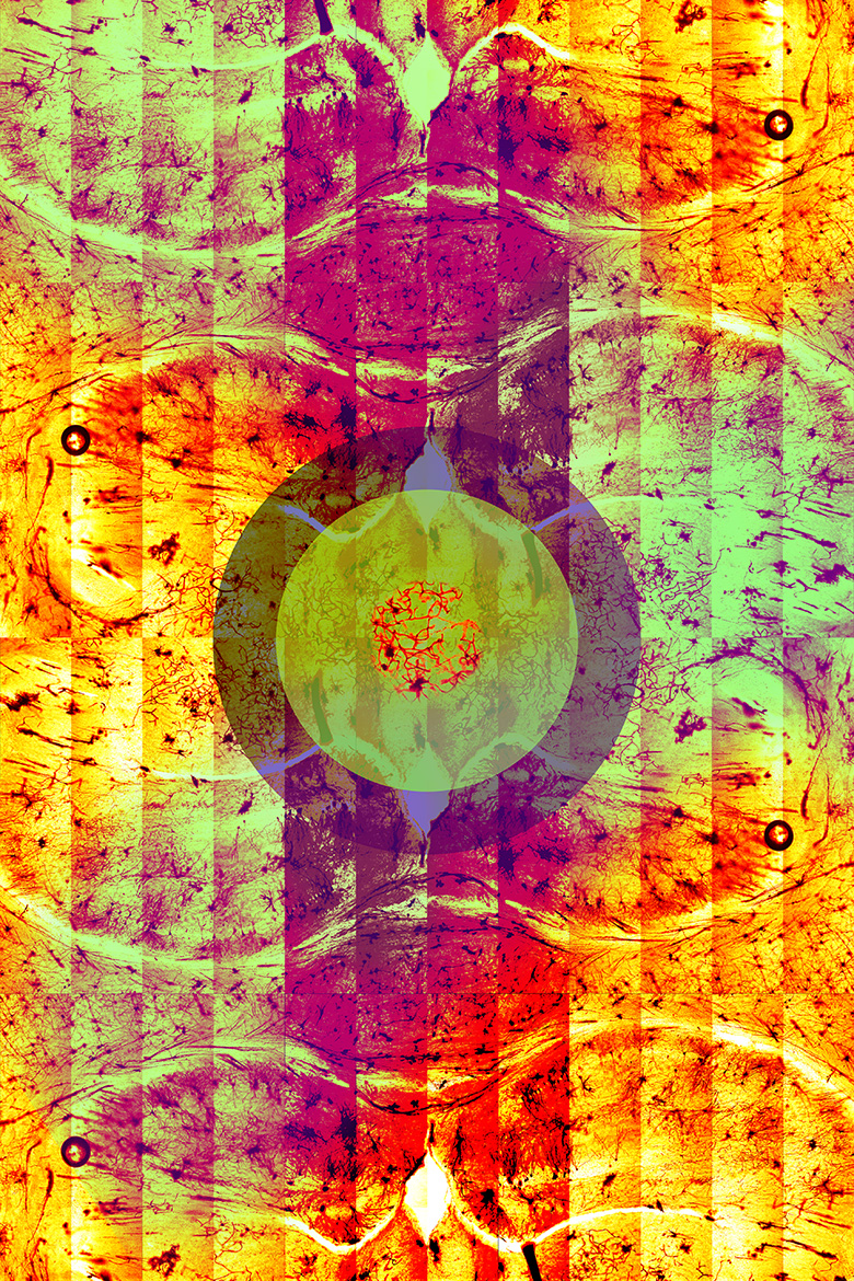 Dentate<br />
Scientist Collaborator Chris Seward<br />
Lisa Stubbs Labratory<br />
Multiphoton Confocal Microscope Zeiss 710 microscope