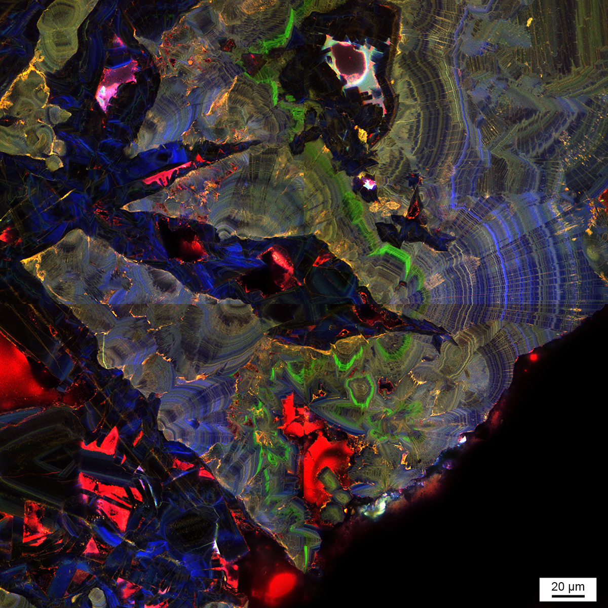 Fluorescence micrograph of a human kidney stone from the Mayo Clinic.